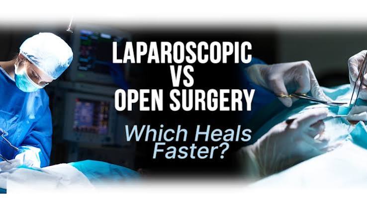 You’re a Laparoscopic Surgeon. But Are You Ready to Open?